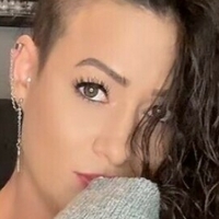 rocking_alopecia Alaston